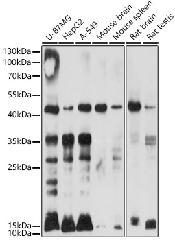 Ubiquitin Rabbit Polyclonal Antibody