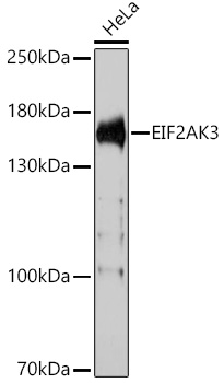 EIF2AK3 Rabbit Polyclonal Antibody