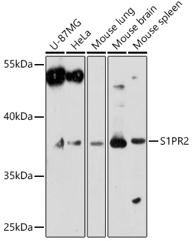S1PR2 Rabbit Polyclonal Antibody