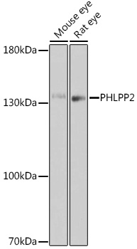 PHLPP2 Polyclonal Antibody