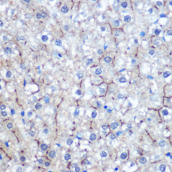 HILPDA Polyclonal Antibody