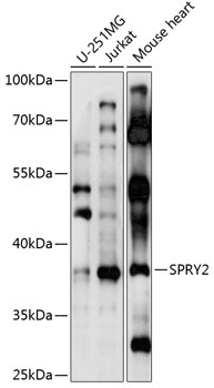 SPRY2 Polyclonal Antibody