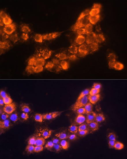 LAMC2 Rabbit Polyclonal Antibody