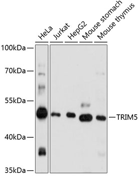 TRIM5 Polyclonal Antibody