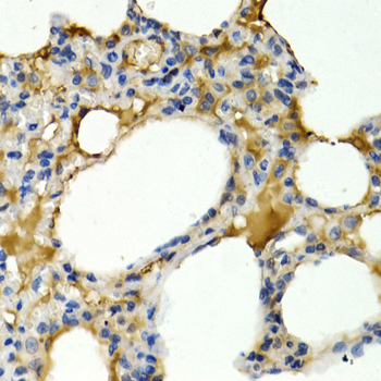 IL9 Rabbit Polyclonal Antibody