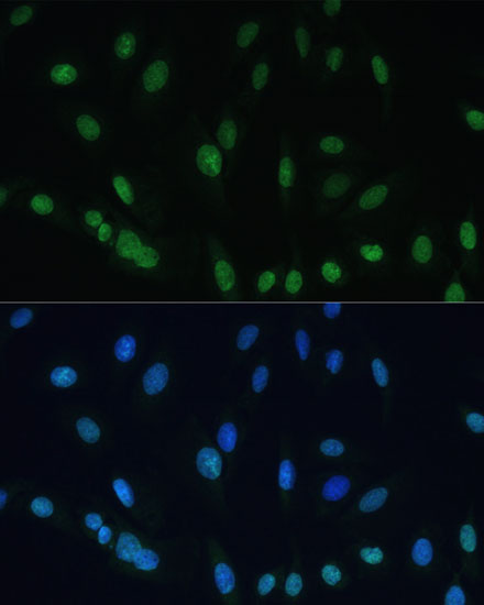 Histone H2AX Rabbit Polyclonal Antibody