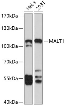 MALT1 antibody