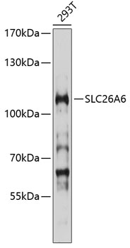 SLC26A6 Rabbit Polyclonal Antibody