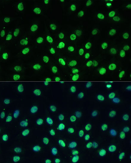 TRIM28 Rabbit Polyclonal Antibody