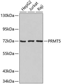PRMT5 Rabbit Polyclonal Antibody