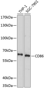 CD86 Rabbit Polyclonal Antibody