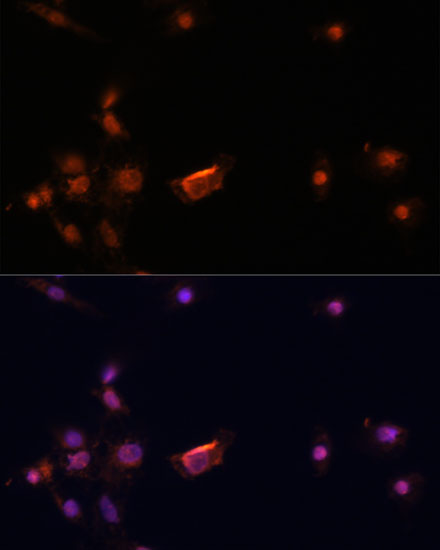 BRCA2 Rabbit Polyclonal Antibody