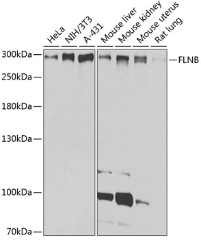 FLNB Polyclonal Antibody