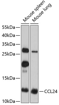 CCL24 antibody