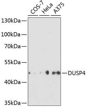 DUSP4 Rabbit Polyclonal Antibody