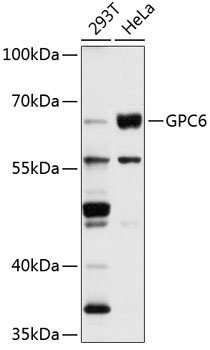 GPC6 Rabbit Polyclonal Antibody