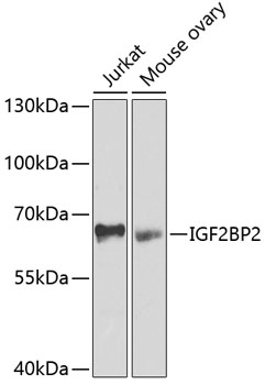 IGF2BP2 Rabbit Polyclonal Antibody