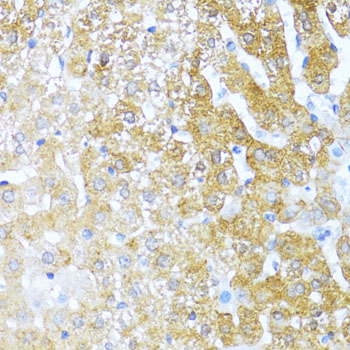SERPINA3 Rabbit Polyclonal Antibody