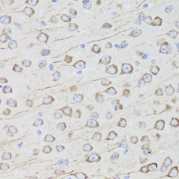 AQP0 antibody
