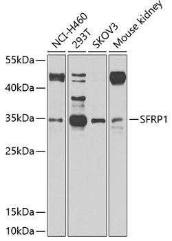 SFRP1 Rabbit Polyclonal Antibody