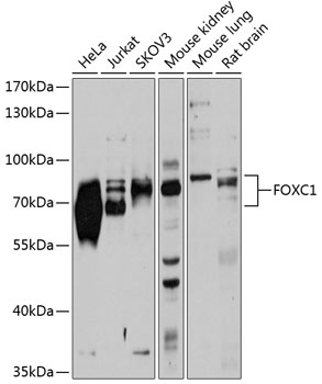 FOXC1 Rabbit Polyclonal Antibody