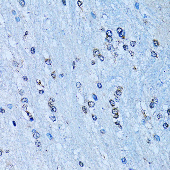 NFKB2 antibody