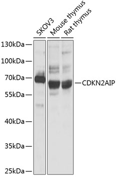 CDKN2AIP Rabbit Polyclonal Antibody