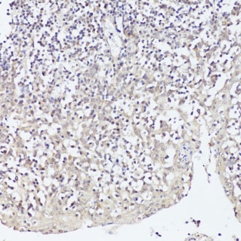 Twist Rabbit Polyclonal Antibody
