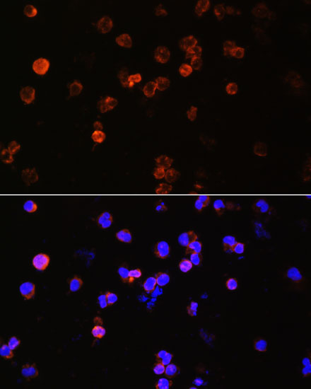 CXCR2 Rabbit Polyclonal Antibody
