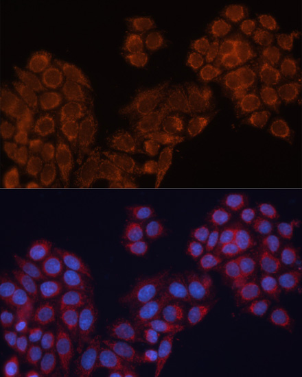 ALDH6A1 Rabbit Polyclonal Antibody