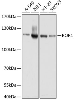 ROR1 Rabbit Polyclonal Antibody