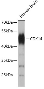 CDK14 Rabbit Polyclonal Antibody