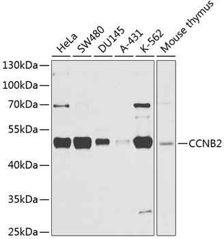 CCNB2 Rabbit Polyclonal Antibody