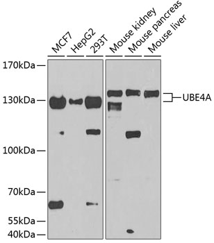 UBE4A Rabbit Polyclonal Antibody