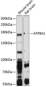 ATP8A1 Polyclonal Antibody