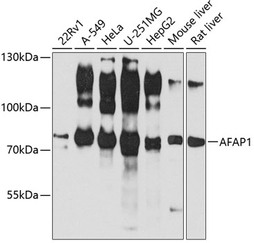 AFAP1 Rabbit Polyclonal Antibody