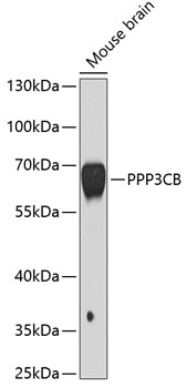 PPP3CB Polyclonal Antibody