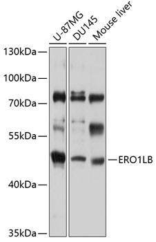 ERO1LB Polyclonal Antibody