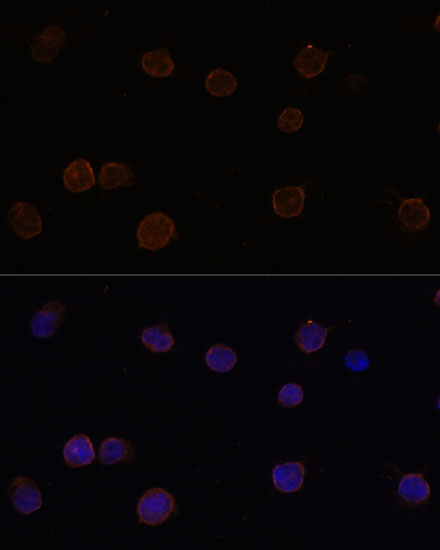ANO2 Polyclonal Antibody