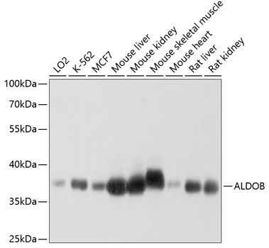 ALDOB Rabbit Polyclonal Antibody