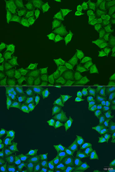 ATP5J Rabbit Polyclonal Antibody