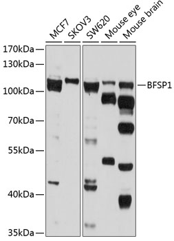 BFSP1 Polyclonal Antibody