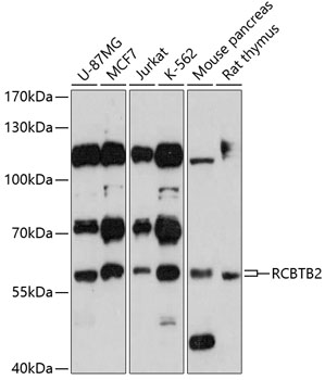 RCBTB2 Polyclonal Antibody