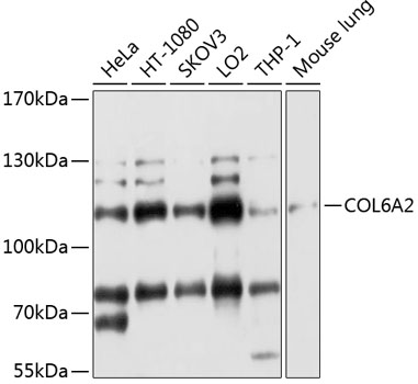 COL6A2 Polyclonal Antibody
