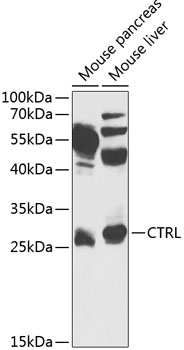 CTRL Polyclonal Antibody