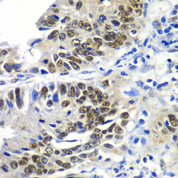 DACH1 Rabbit Polyclonal Antibody
