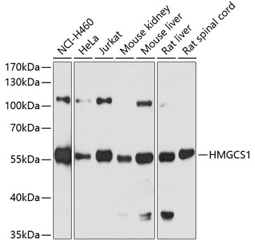 HMGCS1 Rabbit Polyclonal Antibody