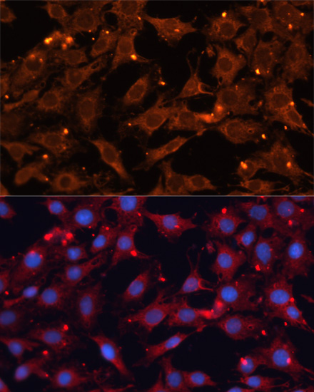 INPP5B Rabbit Polyclonal Antibody