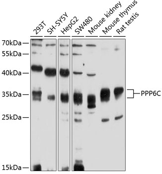 PPP6C Polyclonal Antibody