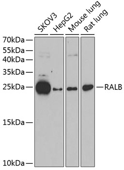 RALB Rabbit Polyclonal Antibody